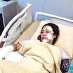 杨盼盼烧伤后首开腔:贺岁喜剧拍成“灾难片” 杨盼盼烧伤后首开腔:贺岁喜剧拍成“灾难片”